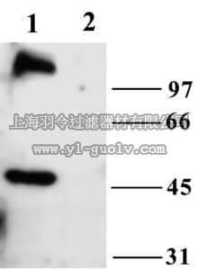 merck millipore,默克密理博,AB5574-50UL,Anti-TrpC6 Antibody