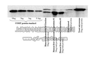 merck millipore,默克密理博,AB5873,Anti-Catechol O-methyltransferase Antibody