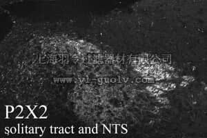merck millipore,默克密理博,AB5894,Anti-P2X2 Receptor Antibody