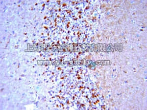 merck millipore,默克密理博,AB5940,Anti-BACE Antibody, CT