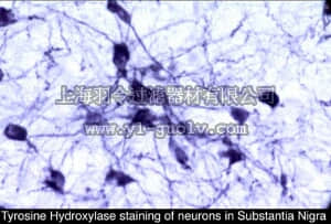 merck millipore,默克密理博,AB5986,Anti-Tyrosine Hydroxylase Antibody