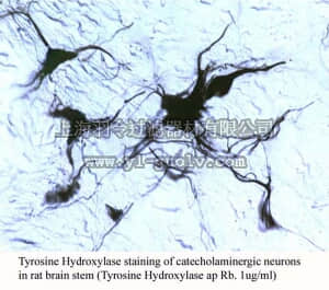 merck millipore,默克密理博,AB5986P,Anti-Tyrosine Hydroxylase Antibody