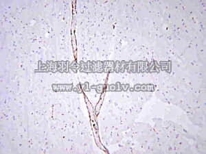 merck millipore,默克密理博,AB7356,Anti-von Willibrand Factor Antibody