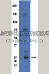 merck millipore,默克密理博,AB8143,Anti-Connexin 26 Antibody merck millipore,默克密理博,AB8143,Anti-Connexin 26 Antibody