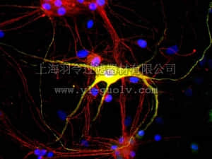merck millipore,默克密理博,AB9282,Anti-Peripherin Antibody