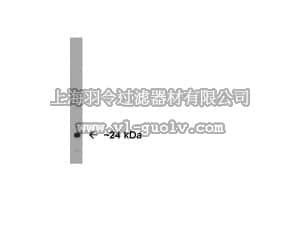 merck millipore,默克密理博,AB9724,Anti-Protein Gene Product 9.5 Antibody