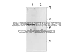 merck millipore,默克密理博,AB9764-200UL,Anti-Sloβ1 Antibody