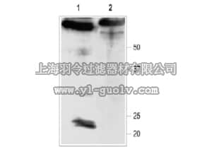 merck millipore,默克密理博,AB9776-50UL,Anti-Sloβ4 Antibody