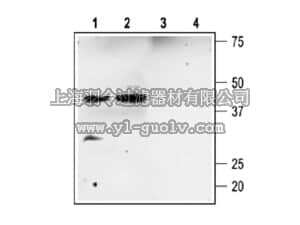 merck millipore,默克密理博,AB9778-200UL,Anti-Sloβ2 Antibody