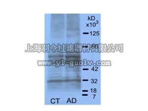 merck millipore,默克密理博,AB9890,Anti-AGE (Advanced Glycated End-products) Antibody