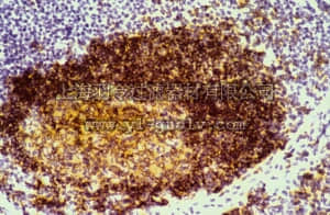 merck millipore,默克密理博,CBL147,Anti-BL-CAM Antibody, clone RFB4