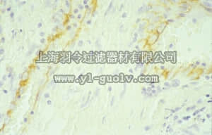 merck millipore,默克密理博,CBL468,Anti-PECAM-1 Antibody, domains 3-6 of human PECAM-1, clone HC1/6