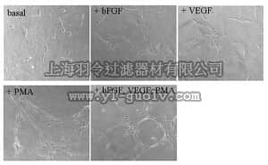merck millipore,默克密理博,ECM630,Fibrin In Vitro Angiogenesis Assay