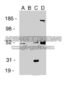 merck millipore,默克密理博,GR39,Anti-Estrogen Receptor β (Ab-2) Mouse mAb (9.88)