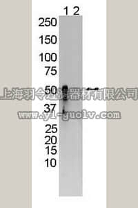 merck millipore,默克密理博,MAB10037,Mouse Anti-Rat Cytochrome P450 CYP 2b1/2BC.B/C4 Antibody