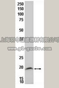 merck millipore,默克密理博,MAB10139,Anti-LIM Domain Only 2 Antibody, clone 2E6