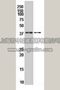 merck millipore,默克密理博,MAB10144,Anti-LHX5 Antibody, clone 1C12