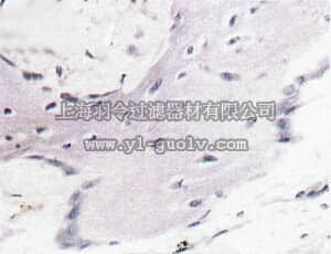 merck millipore,默克密理博,MAB1061,Anti-Bone Sialoprotein II Antibody, CT, clone ID1.2