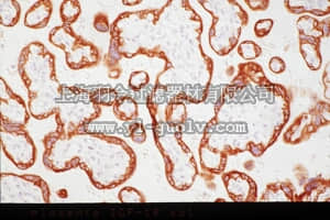 merck millipore,默克密理博,MAB1120,Anti-Insulin-like Growth Factor-1 Receptor Antibody, α-subunit, clone 24-31