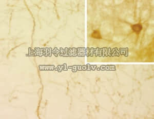 merck millipore,默克密理博,MAB1564,Anti-Serotonin Transporter Antibody, clone 17-7A4