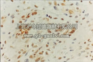 merck millipore,默克密理博,MAB16200,Anti-MGMT Antibody, clone MT3.1