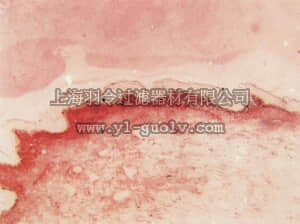 merck millipore,默克密理博,MAB1912,Anti-Procollagen Type I Antibody, NT, clone M-58