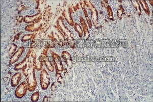 merck millipore,默克密理博,MAB2011,Anti-Mucin MUC5AC Antibody, clone CLH2
