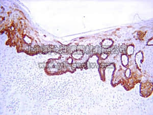 merck millipore,默克密理博,MAB3238,Anti-Cytokeratin 19 Antibody, clone RCK108