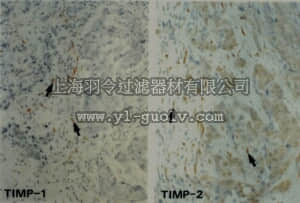 merck millipore,默克密理博,MAB3310,Anti-TIMP-2 Antibody, clone 67-4H11