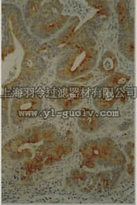 merck millipore,默克密理博,MAB3315,Anti-MMP-7 Antibody, clone 141-7B2