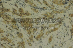 merck millipore,默克密理博,MAB3319,Anti-MMP-14 Antibody, catalytic domain, clone 114-6G6