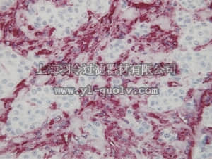merck millipore,默克密理博,MAB3400,Anti-Vimentin Antibody, clone V9