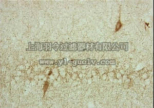 merck millipore,默克密理博,MAB351,Anti-Glutamate Decarboxylase Antibody, 65 kDa isoform, clone GAD-6