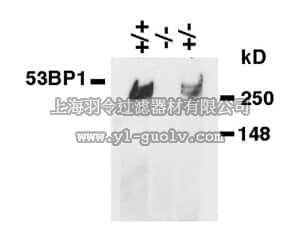 merck millipore,默克密理博,MAB3804,Anti-53BP1 Antibody, clone BP18