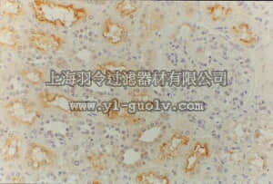 merck millipore,默克密理博,MAB4120,Anti-MDR1 Antibody, clone JSB-1