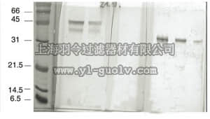 merck millipore,默克密理博,MAB5328,Anti-RAGE Antibody, clone DD/A11 or A11