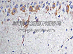 merck millipore,默克密理博,MAB5404,Anti-Nitrotyrosine Antibody, clone 2A8.2