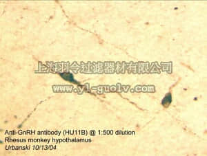 merck millipore,默克密理博,MAB5456,Anti-Gonadotropin-Releasing Hormone Antibody, NT, clone HU11B