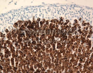 merck millipore,默克密理博,MAB6020,Anti-Cytochrome P450 11β-Hydroxylase Antibody, clone 11B2-1A4