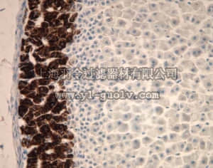 merck millipore,默克密理博,MAB6021,Anti-Cytochrome P450 Aldosterone Synthase Antibody, clone 1G5